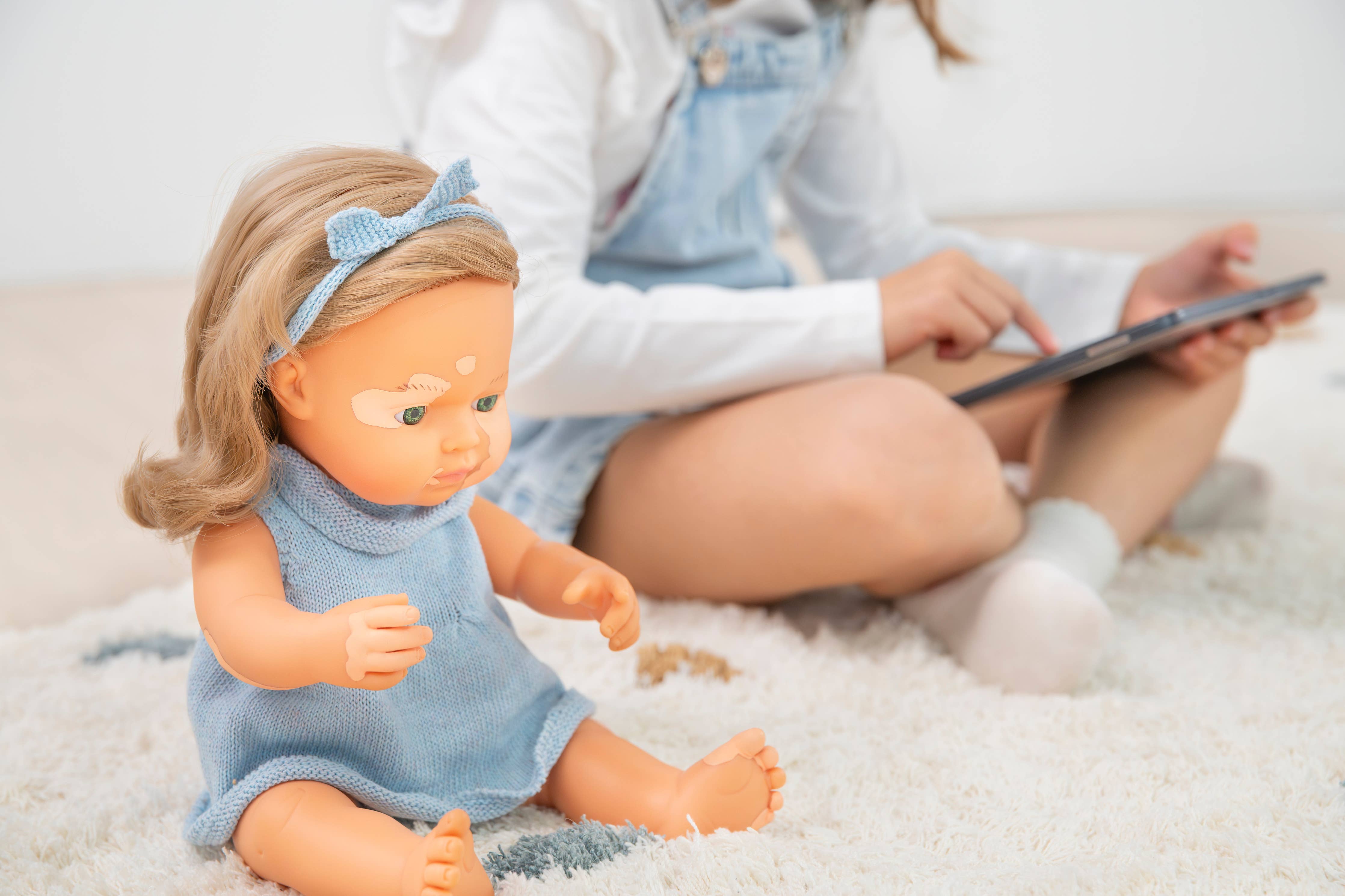 Blonde Girl Vitiligo Doll